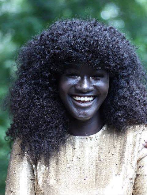 Remember The Young Lady With The Darkest Skin In The World? Meet The Man Putting Smiles On Her Face