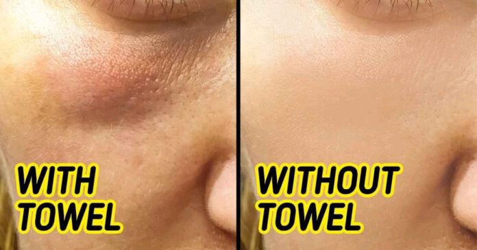 See Reasons Why You Shouldn’t Use a Towel to Dry Your Face