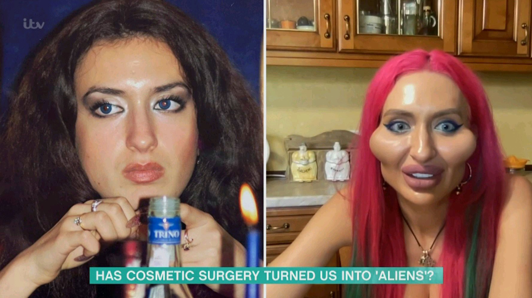 Before And After Surgery Photos Of 4 Celebrities: They Will Leave You Speechless