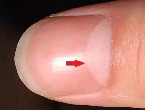 What This Half-Moon On The Fingernails Says About Your Health