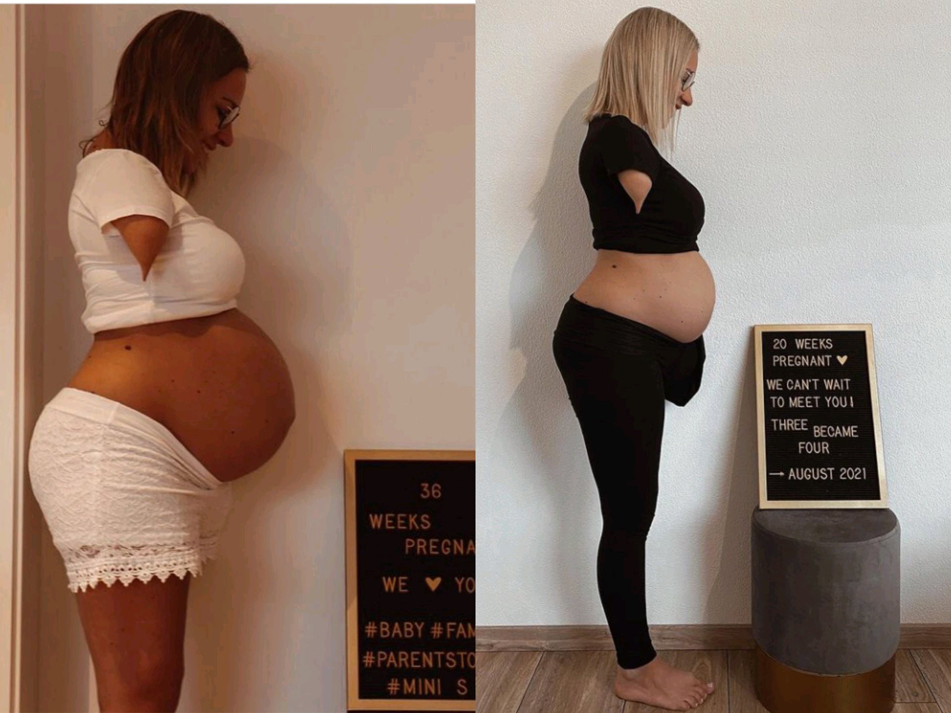 Meet The Pregnant Mother With No Hands And One Leg