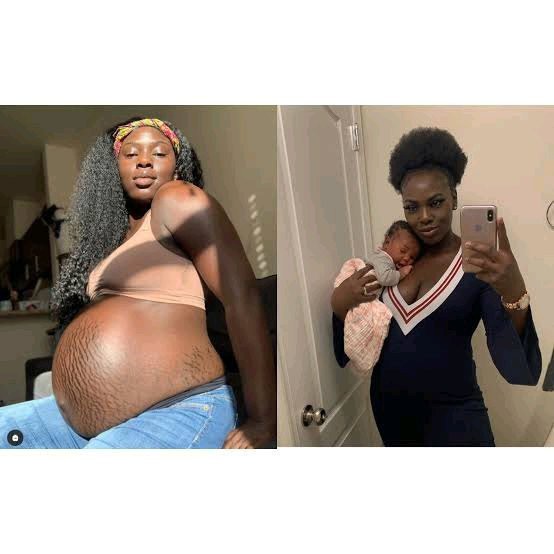 Check Out Lovely Pictures Of Pregnant Women Embracing Their Stretch Marks