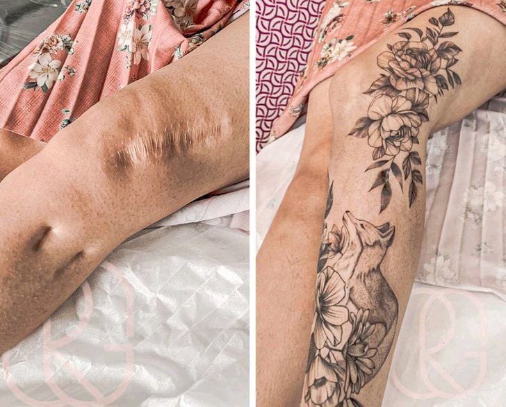 The Transformation Of Twenty-Two Scars Into Beatify Tattoos