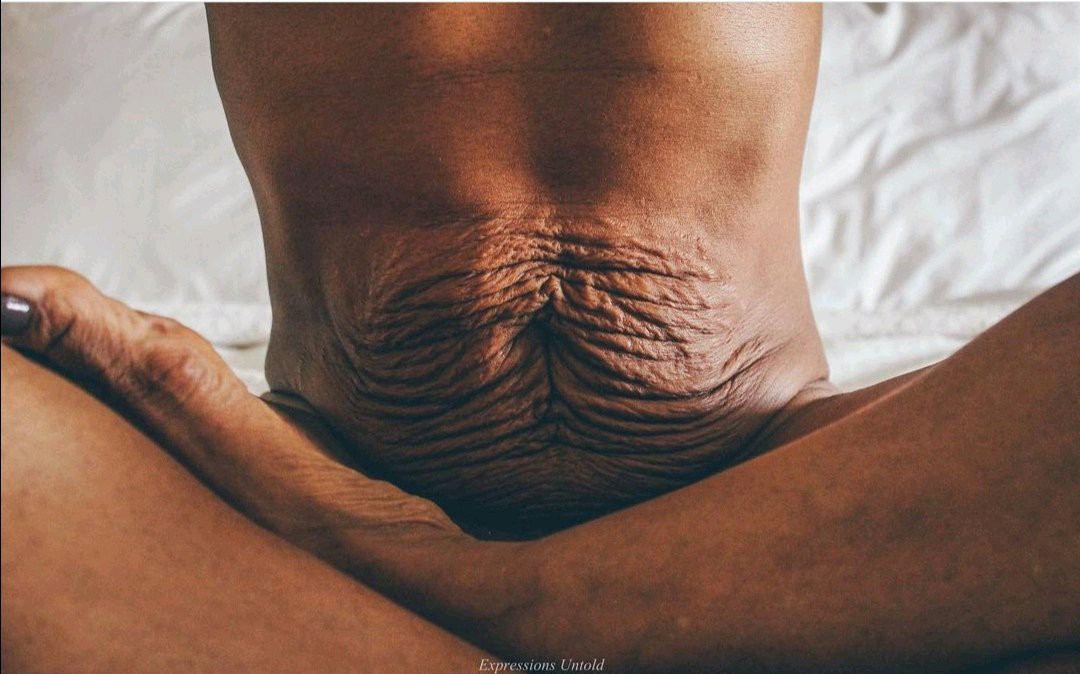 What The Female Body Really Looks After Child Birth